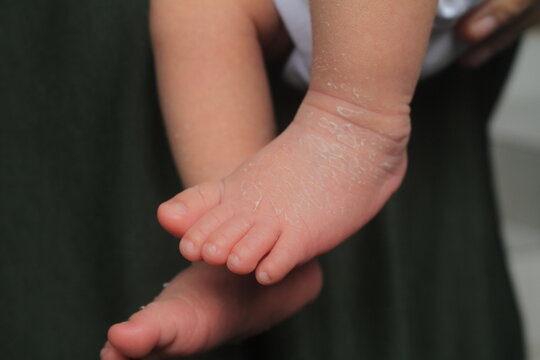 Newborn baby feet with soft, white and smooth skin texture
