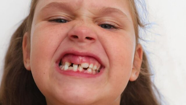 Animated shot of small blond little girl growling and grinning at the camera with toothless mouth on white studio background. Wonky, crooked milk teeth and bad bite. Need hygiene and dental checking.