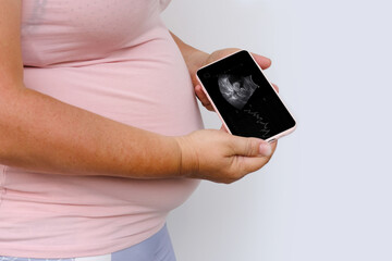 pregnant woman holds mobile phone with ultrasound screen examination, small child rolls over in mother's belly, concept pregnancy reproduction, healthcare pregnancy, happy motherhood, selective focus