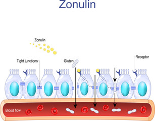 intestinal cells with Zonulin receptors, normal and Faulty tight