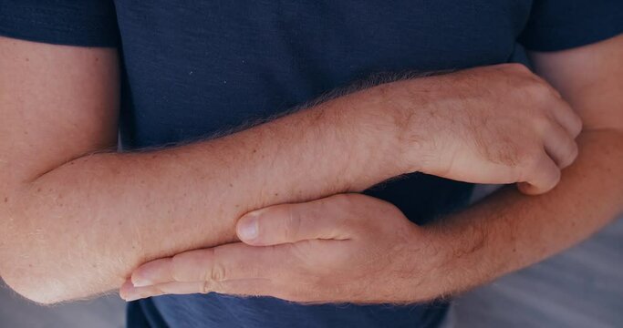 Close up of man hairy arm skin with hyperpigmentation