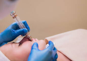 Woman cleaning skin pores using vacuum blackhead remover, cosmetic procedure.