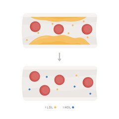 Infografía función Omega 9 en arterias y venas. Aumenta el colesterol bueno HDL y disminuye el colesterol malo LDL. Reducción de la placa del colesterol, grasa y triglicéridos  en vaso sanguíneo 