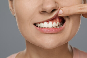 Woman showing healthy gums on gray background, closeup