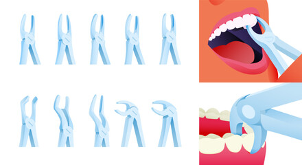 Dental Extracting Forceps Set. Cropped Beautiful Female Face White Teeth with Extracting Forceps Close Up Set. Modern Flat Vector Illustration.
