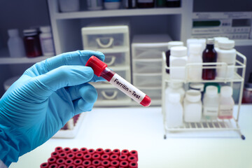 ferritin test to look for abnormalities from blood
