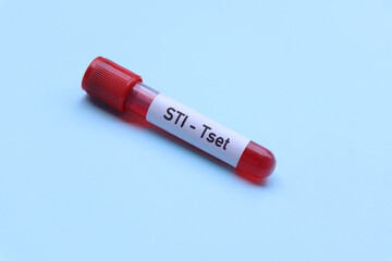 STI test to look for abnormalities from blood