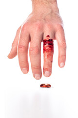 Hand with bloody finger and wedding ring