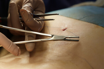 suturing a wound in the operating room