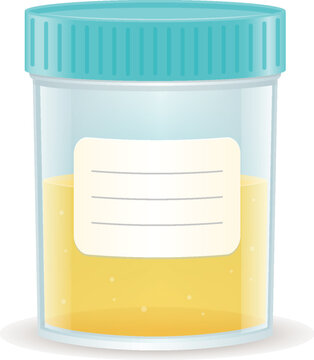 Specimen cup with urine realistic vector illustration isolated on white