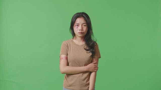 Young Asian Woman With Bruise On Face And Arms Hugging Herself Being Hurt From Violence While Standing On Green Screen Background In The Studio

