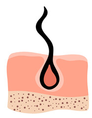 Normal hair growth. Inflammation, skin problems. Anatomy infographics of hair. Flat illustration isolated on the white background.