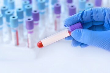 Hand with medical glove of doctor holds test tube with blood sample and blank label for own text on...
