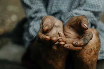 Close up of male wrinkled hands, old man is wearing  skin disease and anxiety Copy space.