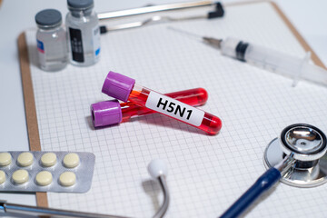 Blood collection tubes H5N1 test positive results,Medical health concept