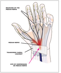 Site of compression of the median nerve in carpal tunnel syndrome