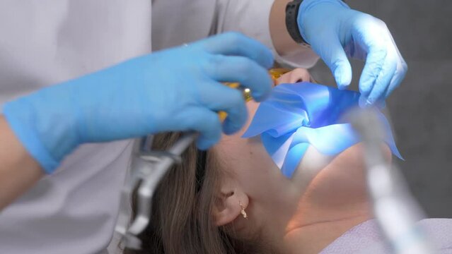 the dentist prepares latex scarf with metal clips for treatment of canals and pulpitis. Latex insulating fabric is installed in oral cavity. treatment and restoration of rotten carious tooth
