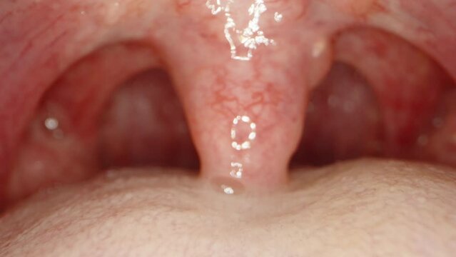 Inside the man's Mouth, a macro tongue with veins and veins. Medical examination.