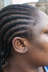 Brown skin with texture and dark spots, hyperpigmentation on brown skin, african american woman...