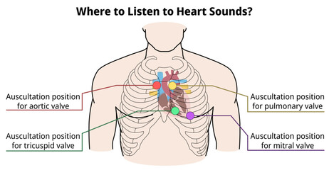 Where to listen to heart sounds? - Auscultation Position of Heart Valve - Vector Medical Illustration