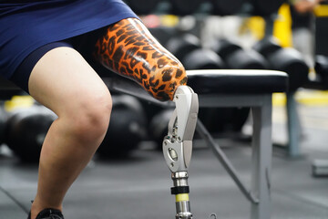 Young female with one prosthetic leg with the practice of using prosthetic legs to walk, exercise and and daily activities