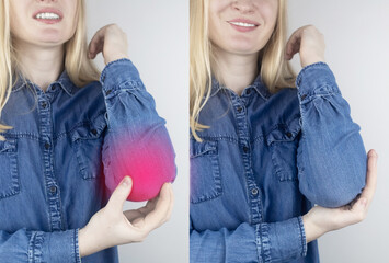 Before and after. Elbow pain. Girl shows consequences of tennis injury, overexertion, bone...