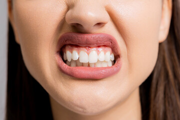 Opened smiled mouth lips and teeth showing brightening smiled at camera close up shot selective...