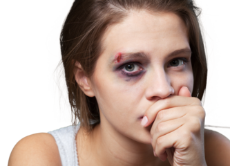 Sad and depressed young girl looking at the camera