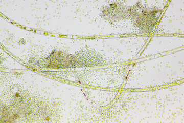 Microscopic view of various species of freshwater algae. Brightfield illumination.