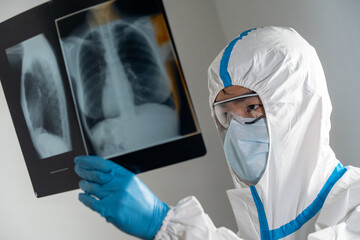Doctor in a Covid ward of a hospital examining x-rays of the lungs.