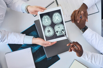 Top view of group of doctors pointing at screen with brain tomography image and discussing it in...