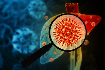 Hepatitis c virus infection. Liver disease. 3d illustration - obrazy, fototapety, plakaty