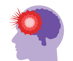 Action On Stroke, Make My Purple, Stroke Awareness, The Stroke Association