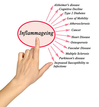 Woman Presenting Consequences of Inflammageing