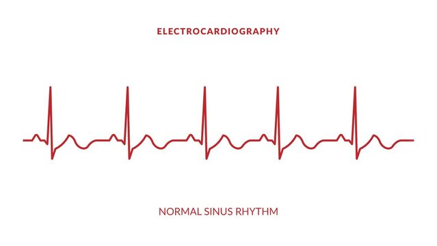 animated normal sinus rhythm. animated ekg display