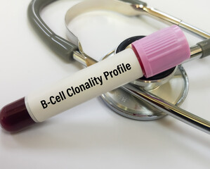 Blood sample for B-Cell Clonality profile (IgH and IgK) by PCR test to diagnosis of B-cell...