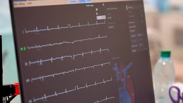 Kyiv, Ukraine - April 2023: Heart Institute. The patient monitor shows heart data.