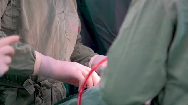 Kyiv, Ukraine - April 2023: Surgeons perform a heart operation. Operating room. Doctors perform heart surgery. Doctors hands close-up