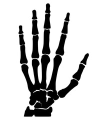 Illustration of an xray of the hand bones