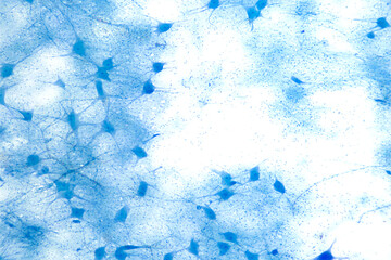 Motor neuron cells, whole mount, 8X light micrograph. Motoneurons under a light microscope. Motor...