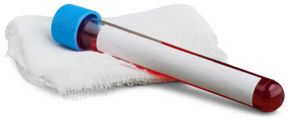 Covid-19 vaccine cost concept. Tube vaccine