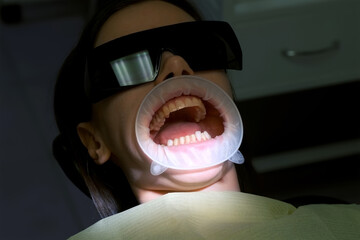 Trying on white veneers on woman's yellow teeth before installing in dentistry. prosthodontics,...