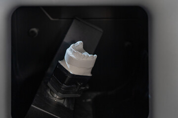 Technician put prosthesis in dental 3D scanner. Close-up of a dental scan with prosthesis. It is...