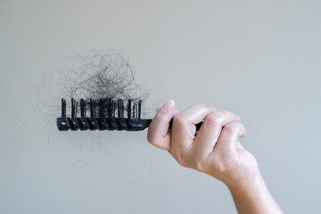 Woman show her brush for presentation of many hair fall after combing in hairbrush.