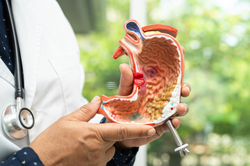 Stomach disease, doctor holding anatomy model for study diagnosis and treatment in hospital.