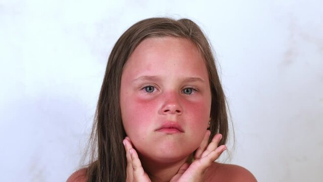 Flushed Cheeks Images – Browse 425 Stock Photos, Vectors, and Video ...
