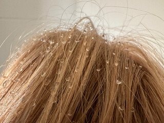 raindrops in a woman's hair. close up