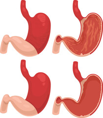 Vector illustration of stomachs in different views, the inner surface of the stomach, empty stomach