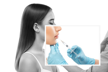 Cosmetologist does injections for lips augmentation and anti wrinkle in the nasolabial folds of a...