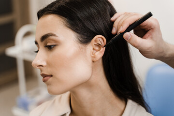 Otoplasty mark-up for surgical reshaping of pinna and ear. Otoplasty markup before ear surgery....